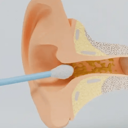WaxClean® : le nettoyage intelligent des oreilles avec caméra HD